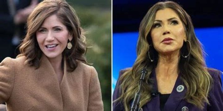 Taylor Fritz's Mother's Face Surgery: A Look at her Cosmetic Journey