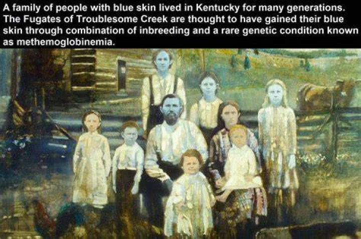 The Mysterious Legacy of the Blue People of Kentucky