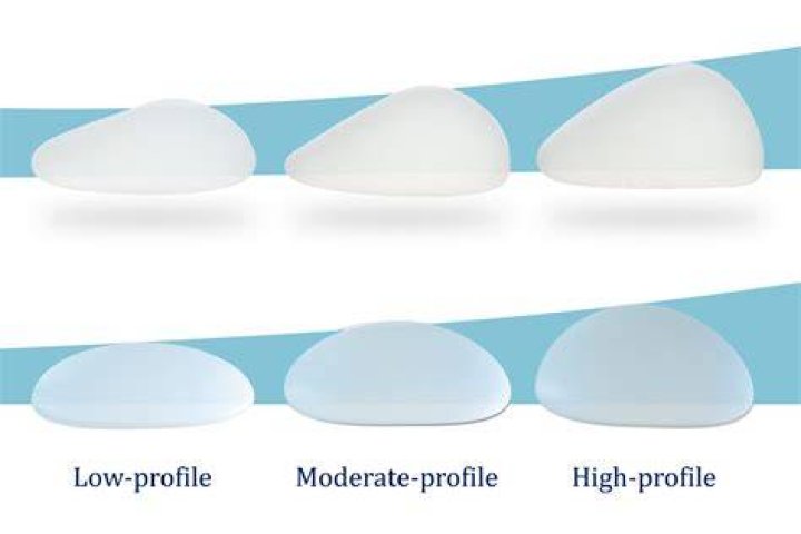 Understanding Fake Tits: The Comprehensive Guide to Breast Augmentation