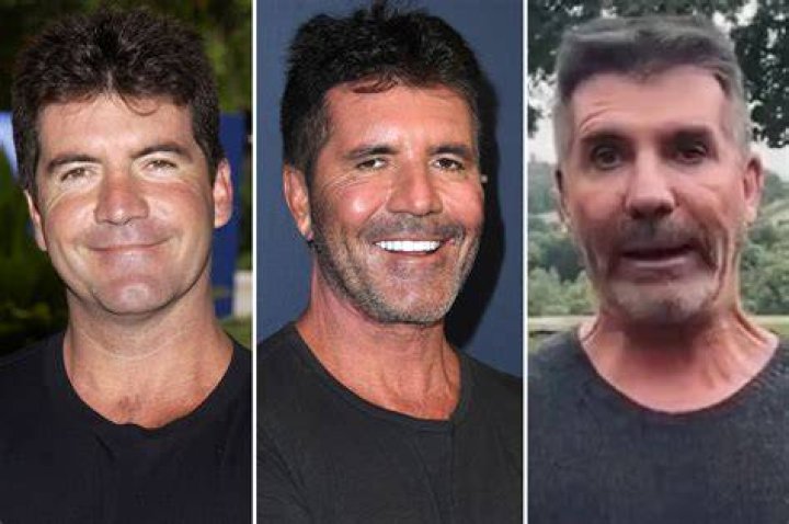 Understanding Simon Cowell's Son's Disability: A Compassionate Insight