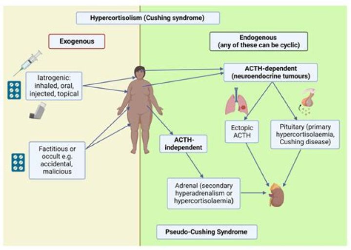 Understanding VATER Syndrome: Causes, Diagnosis, and Management