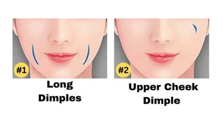 Unlock the Enigmatic Charms of Facial Dimples: Discover the Varieties