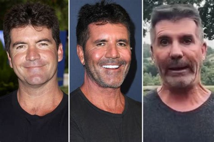 What Condition Does Simon Cowell's Son Have? Understanding Eric Cowell's Health Journey